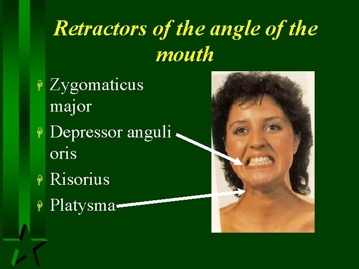 Retractors of the angle of the mouth H H Zygomaticus major Depressor anguli oris