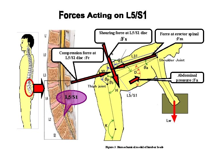 Shearing force at L 5/S 1 disc : Fs Force at erector spinal :
