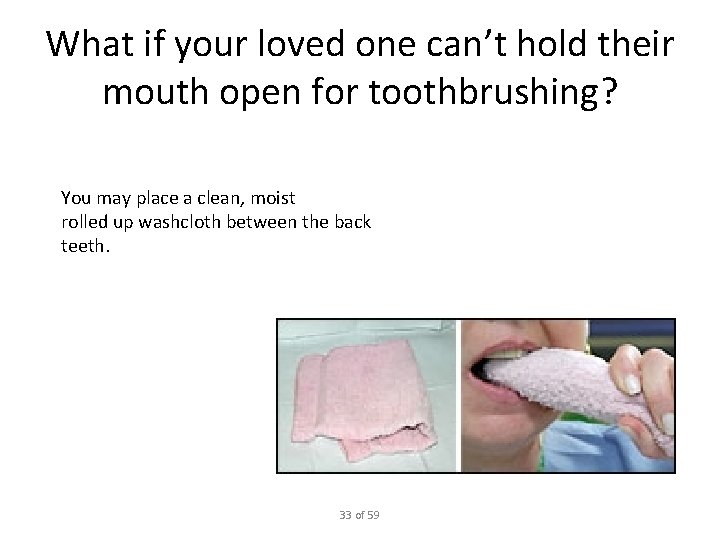 What if your loved one can’t hold their mouth open for toothbrushing? You may