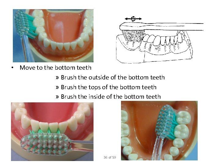  • Move to the bottom teeth » Brush the outside of the bottom