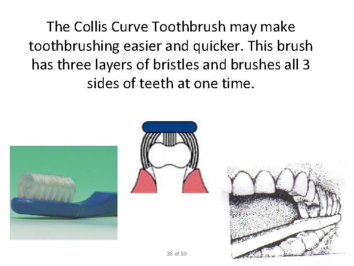 The Collis Curve Toothbrush may make toothbrushing easier and quicker. This brush has three