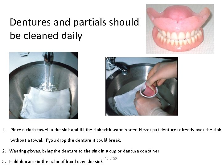 Dentures and partials should be cleaned daily 1. Place a cloth towel in the