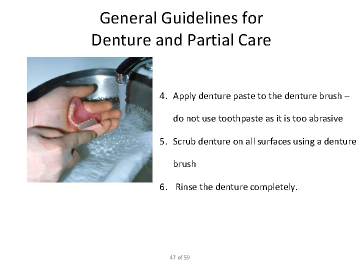 General Guidelines for Denture and Partial Care 4. Apply denture paste to the denture