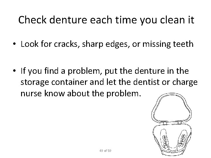 Check denture each time you clean it • Look for cracks, sharp edges, or