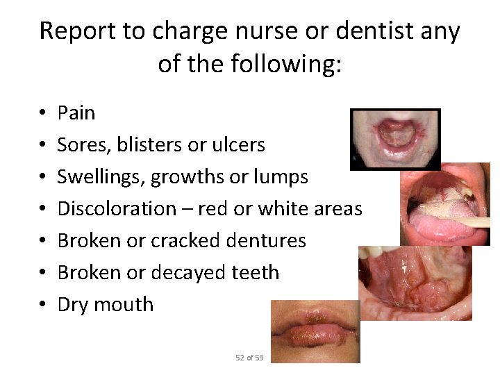 Report to charge nurse or dentist any of the following: • • Pain Sores,