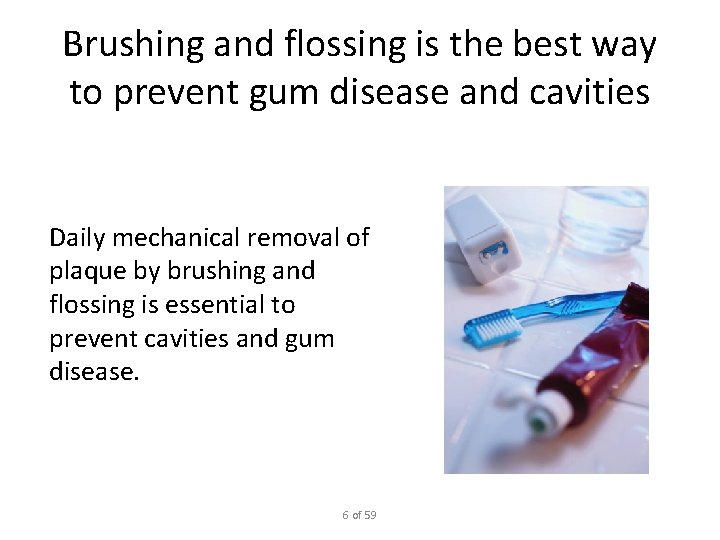 Brushing and flossing is the best way to prevent gum disease and cavities Daily