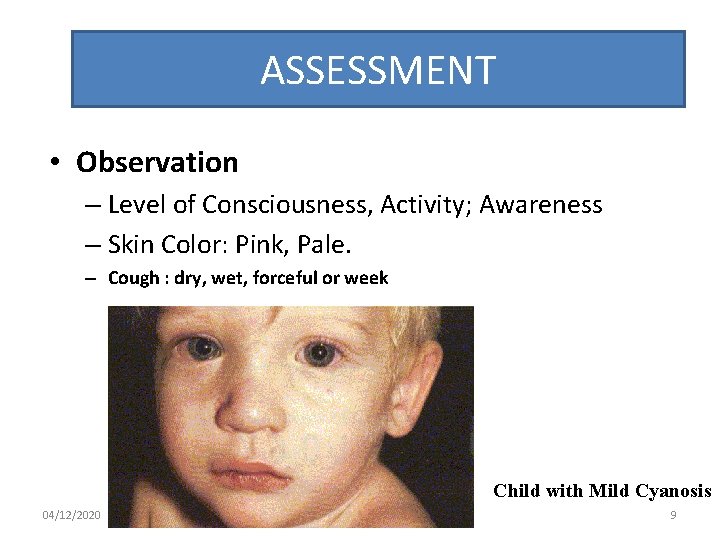 ASSESSMENT • Observation – Level of Consciousness, Activity; Awareness – Skin Color: Pink, Pale.