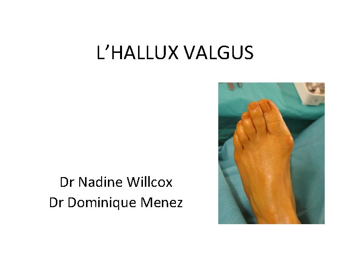 L’HALLUX VALGUS Dr Nadine Willcox Dr Dominique Menez 