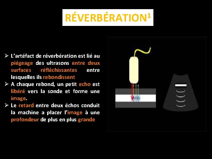 RÉVERBÉRATION 1 Ø L’artéfact de réverbération est lié au piégeage des ultrasons entre deux