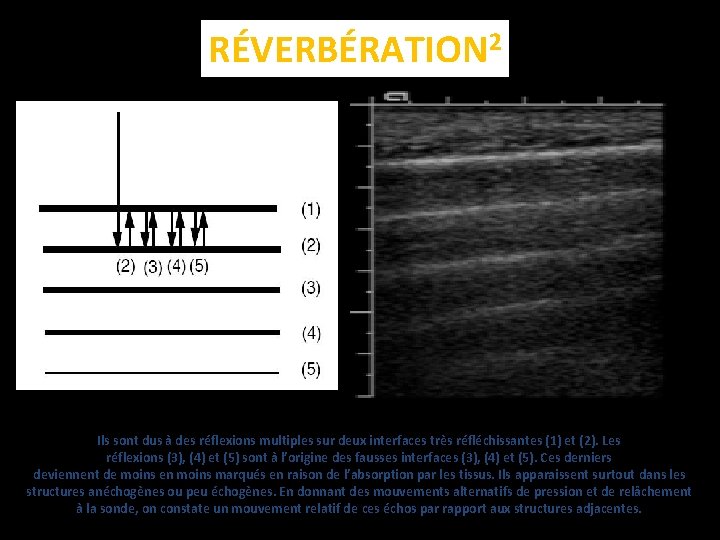 RÉVERBÉRATION 2 Ils sont dus à des réflexions multiples sur deux interfaces très réfléchissantes