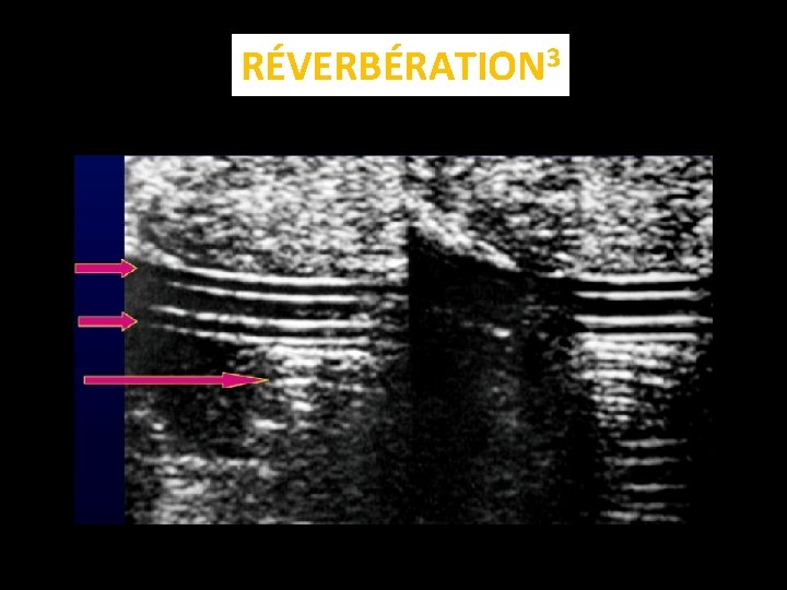 RÉVERBÉRATION 3 