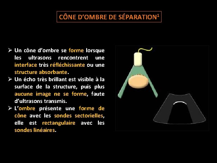 CÔNE D’OMBRE DE SÉPARATION 1 Ø Un cône d’ombre se forme lorsque les ultrasons