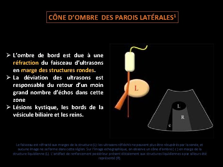 CÔNE D’OMBRE DES PAROIS LATÉRALES 1 Ø L’ombre de bord est due à une