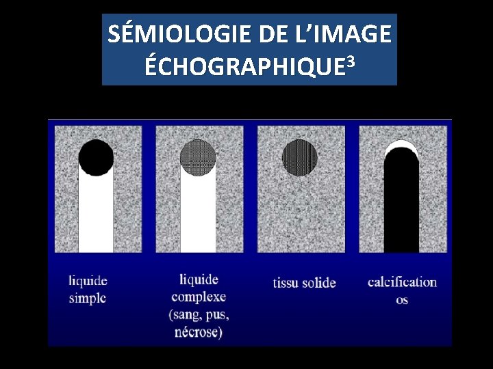 SÉMIOLOGIE DE L’IMAGE ÉCHOGRAPHIQUE 3 