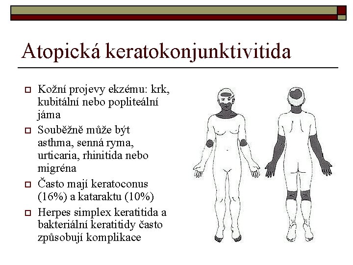 Atopická keratokonjunktivitida o o Kožní projevy ekzému: krk, kubitální nebo popliteální jáma Souběžně může