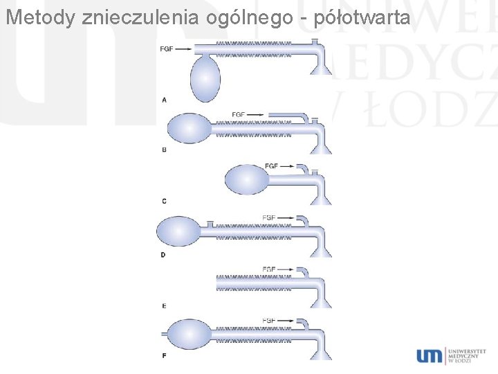 Metody znieczulenia ogólnego - półotwarta 