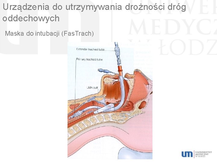 Urządzenia do utrzymywania drożności dróg oddechowych Maska do intubacji (Fas. Trach) 