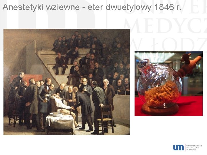 Anestetyki wziewne – eter dwuetylowy 1846 r. 