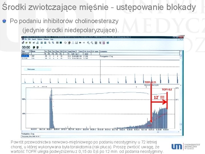 Środki zwiotczające mięśnie – ustępowanie blokady Po podaniu inhibitorów cholinoesterazy (jedynie środki niedepolaryzujące). Powrót