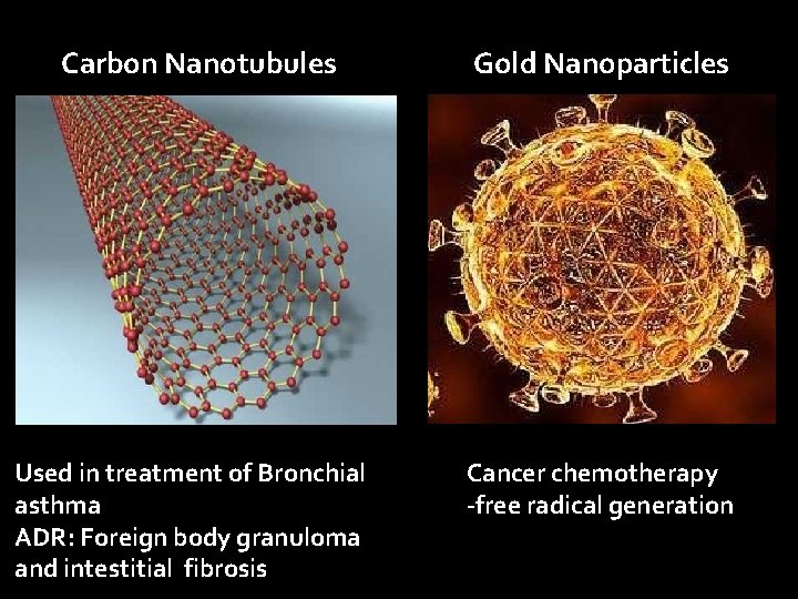 Carbon Nanotubules Gold Nanoparticles Used in treatment of Bronchial asthma ADR: Foreign body granuloma