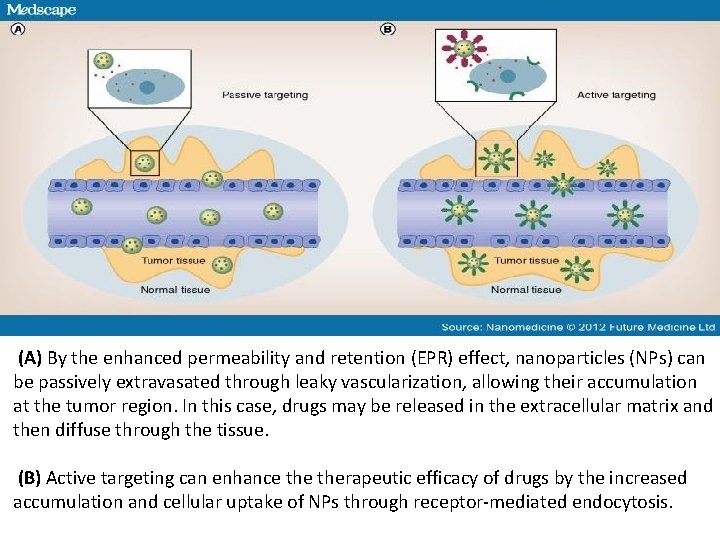  (A) By the enhanced permeability and retention (EPR) effect, nanoparticles (NPs) can be