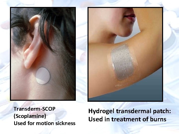 Transderm-SCOP (Scoplamine) Used for motion sickness Hydrogel transdermal patch: Used in treatment of burns