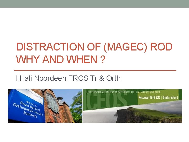 DISTRACTION OF (MAGEC) ROD WHY AND WHEN ? Hilali Noordeen FRCS Tr & Orth