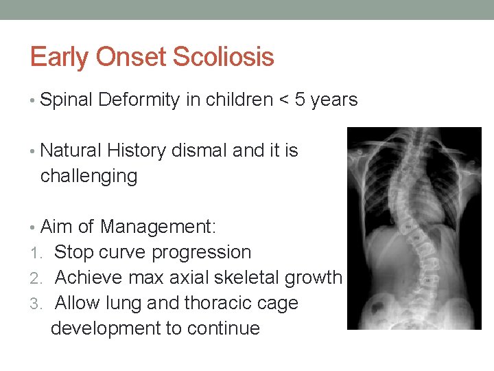 Early Onset Scoliosis • Spinal Deformity in children < 5 years • Natural History