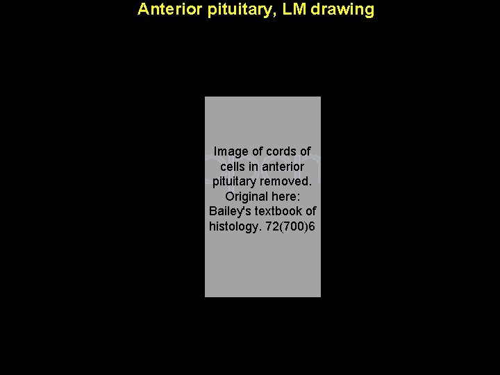 Anterior pituitary, LM drawing Image of cords of cells in anterior pituitary removed. Original