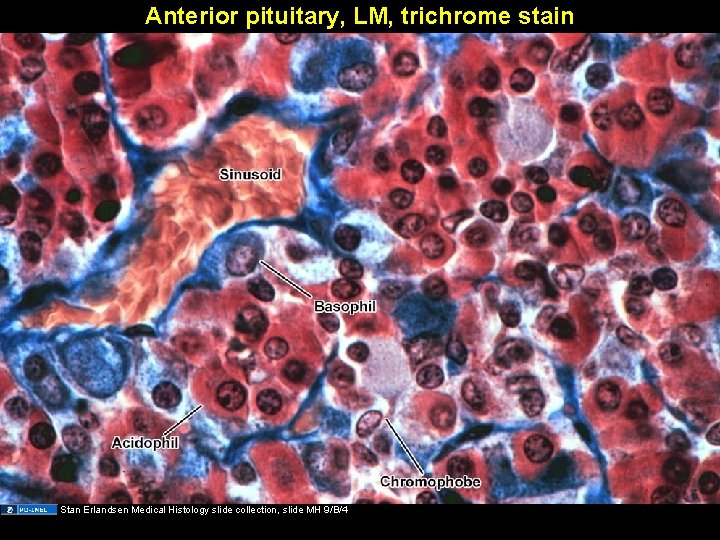 Anterior pituitary, LM, trichrome stain Stan Erlandsen Medical Histology slide collection, slide MH 9/B/4