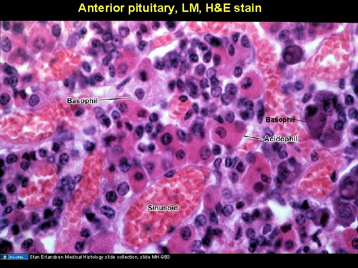 Anterior pituitary, LM, H&E stain Basophil Stan Erlandsen Medical Histology slide collection, slide MH-9