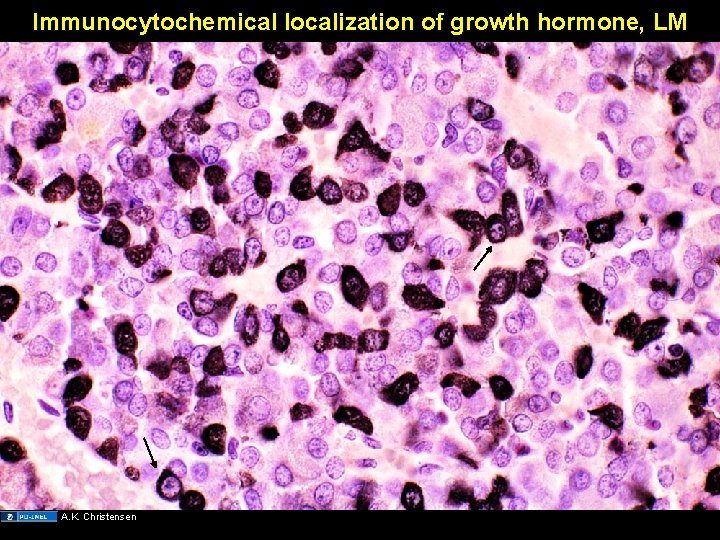 Immunocytochemical localization of growth hormone, LM A. K. Christensen 