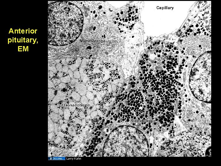 Anterior pituitary, EM Larry Kahn 