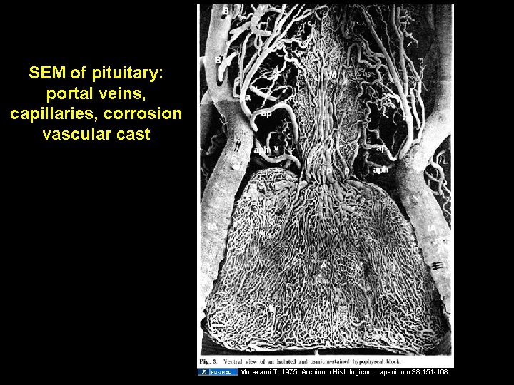SEM of pituitary: portal veins, capillaries, corrosion vascular cast Murakami T, 1975, Archivum Histologicum