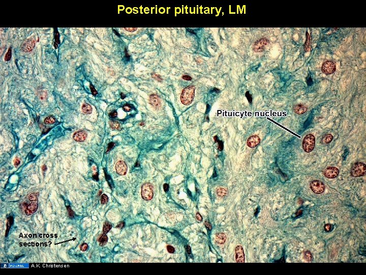 Posterior pituitary, LM Axon cross sections? A. K. Christensen 