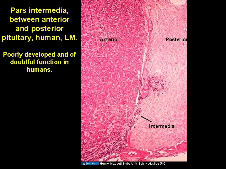 Pars intermedia, between anterior and posterior pituitary, human, LM. Anterior Posterior Poorly developed and