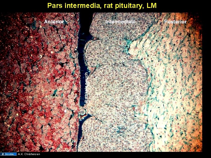 Rathke's pouch Pars intermedia, rat pituitary, LM A. K. Christensen 