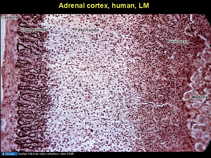 Adrenal cortex, human, LM Hadley Kirkman slide collection, slide K 285 Adrenal cortex, human, LM Hadley Kirkman slide collection, slide K 285
