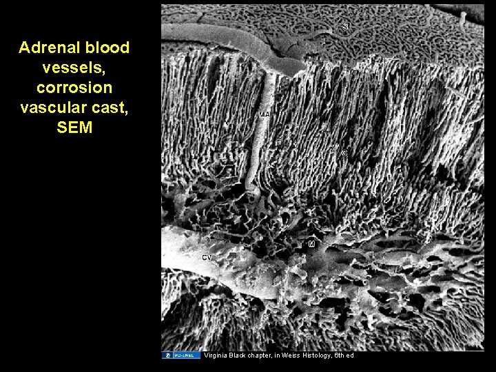 Adrenal blood vessels, corrosion vascular cast, SEM Virginia Black chapter, in Weiss Histology, 6