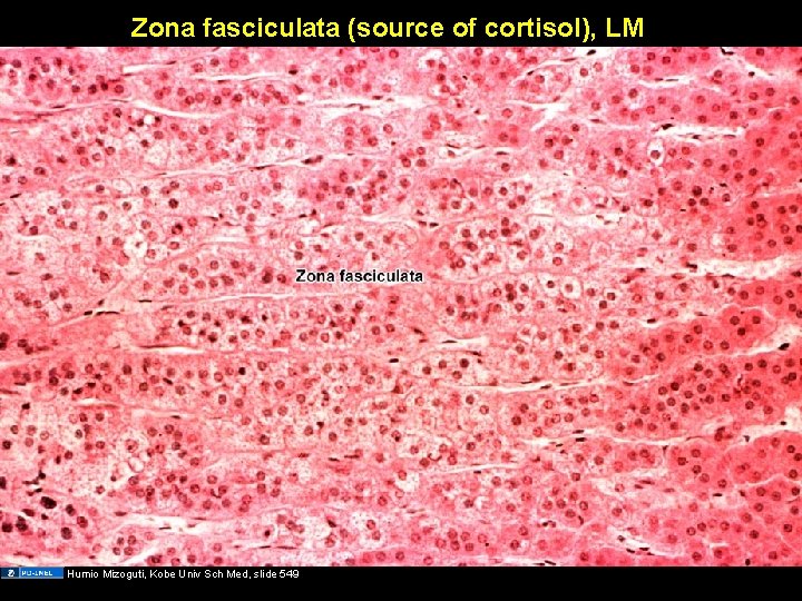 Zona fasciculata (source of cortisol), LM Humio Mizoguti, Kobe Univ Sch Med, slide 549