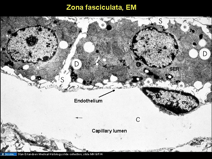 Zona fasciculata, EM SER Endothelium Capillary lumen Stan Erlandsen Medical Histology slide collection, slide