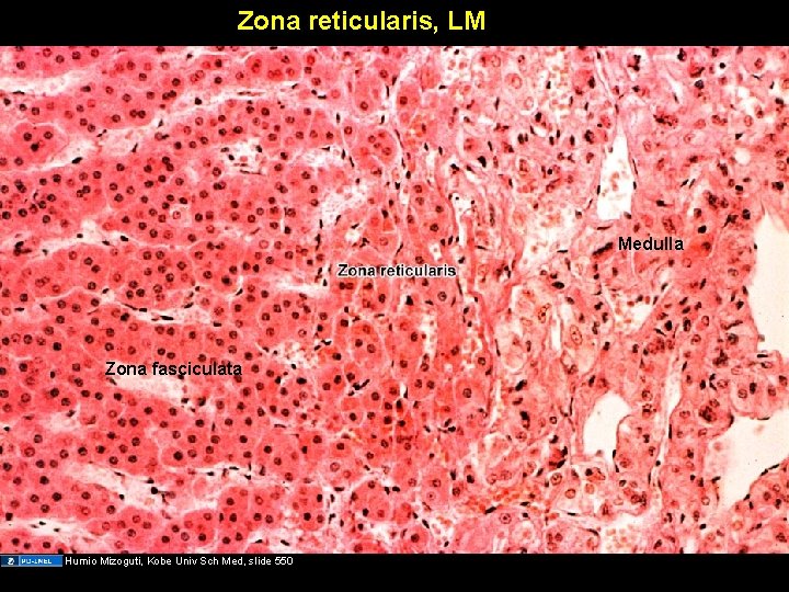 Zona reticularis, LM Medulla Zona fasciculata Humio Mizoguti, Kobe Univ Sch Med, slide 550