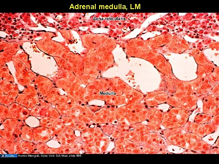 Adrenal medulla, LM Humio Mizoguti, Kobe Univ Sch Med, slide 565 