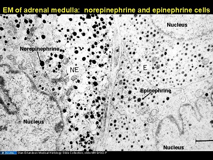 EM of adrenal medulla: norepinephrine and epinephrine cells Nucleus Norepinephrine Epinephrine Nucleus Stan Erlandsen