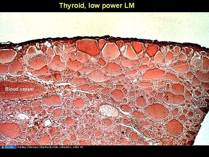 Thyroid, low power LM Blood vessel Hadley Kirkman (Stanford) slide collection, slide 18 