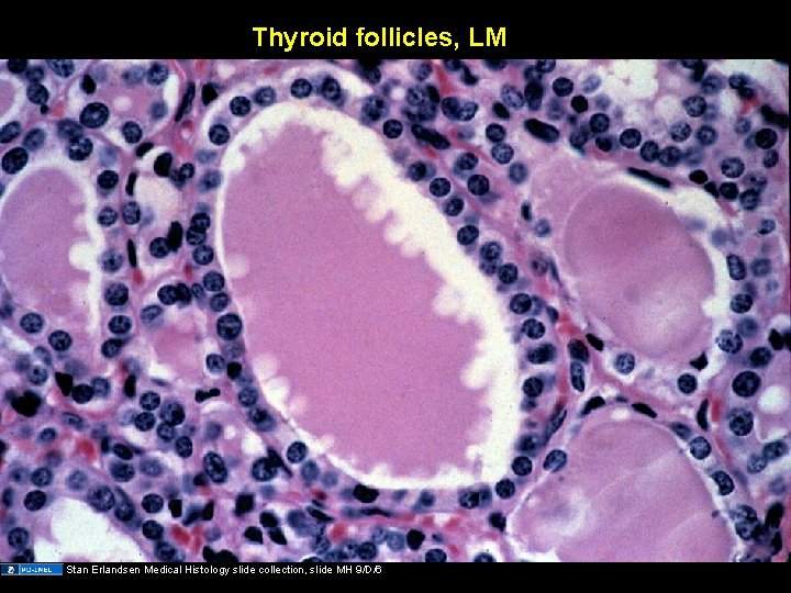 Thyroid follicles, LM Stan Erlandsen Medical Histology slide collection, slide MH 9/D/6 