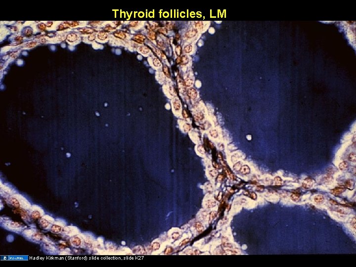 Thyroid follicles, LM Hadley Kirkman (Stanford) slide collection, slide K 27 