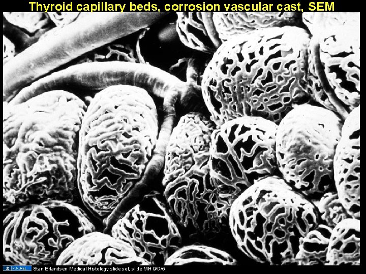 Thyroid capillary beds, corrosion vascular cast, SEM Stan Erlandsen Medical Histology slide set, slide