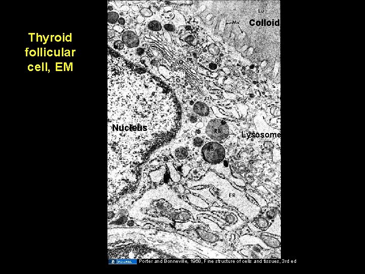 Colloid Thyroid follicular cell, EM Golgi Nucleus Lysosome Porter and Bonneville, 1968, Fine structure