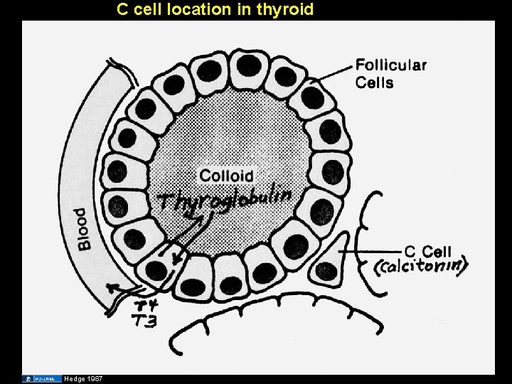 C cell location in thyroid Hedge 1987 
